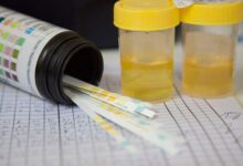 What happens if you have a positive test in the drug test before employment?